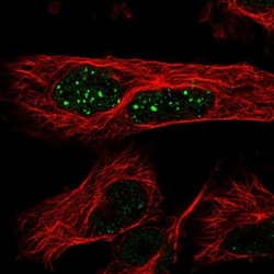 WDR85 Antibody, Novus Biologicals 0.1mL; Unlabeled:Antibodies, Polyclonal